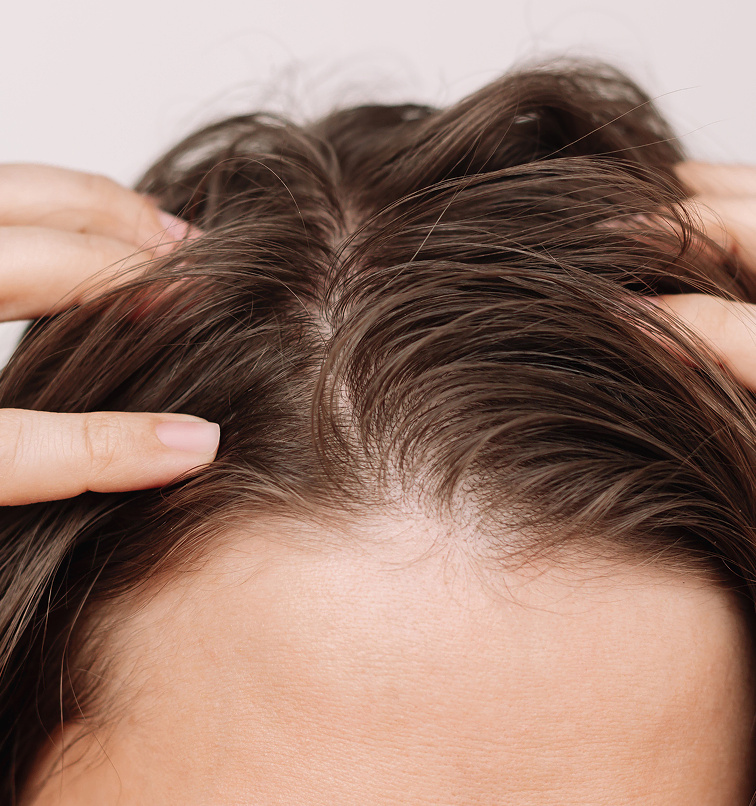 Tricho Talk: De Lorenzo Decodes Scalp Health 