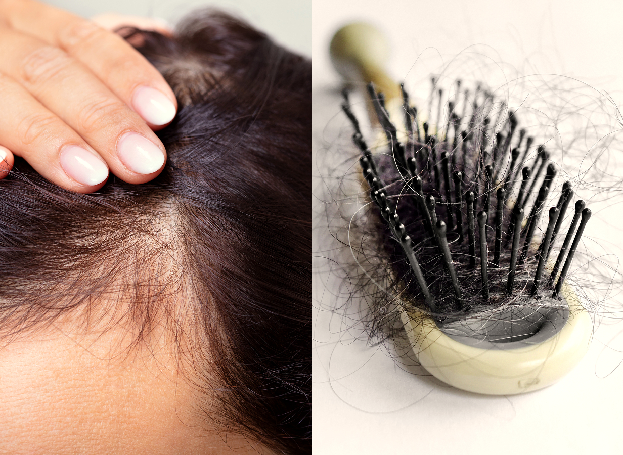 2. Can Hair Loss Be Reversed If Caught Early.png
